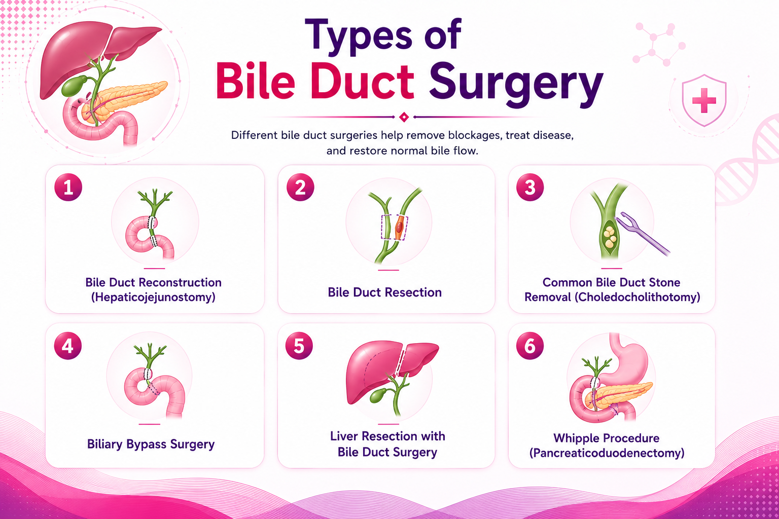 Bile duct surgery types