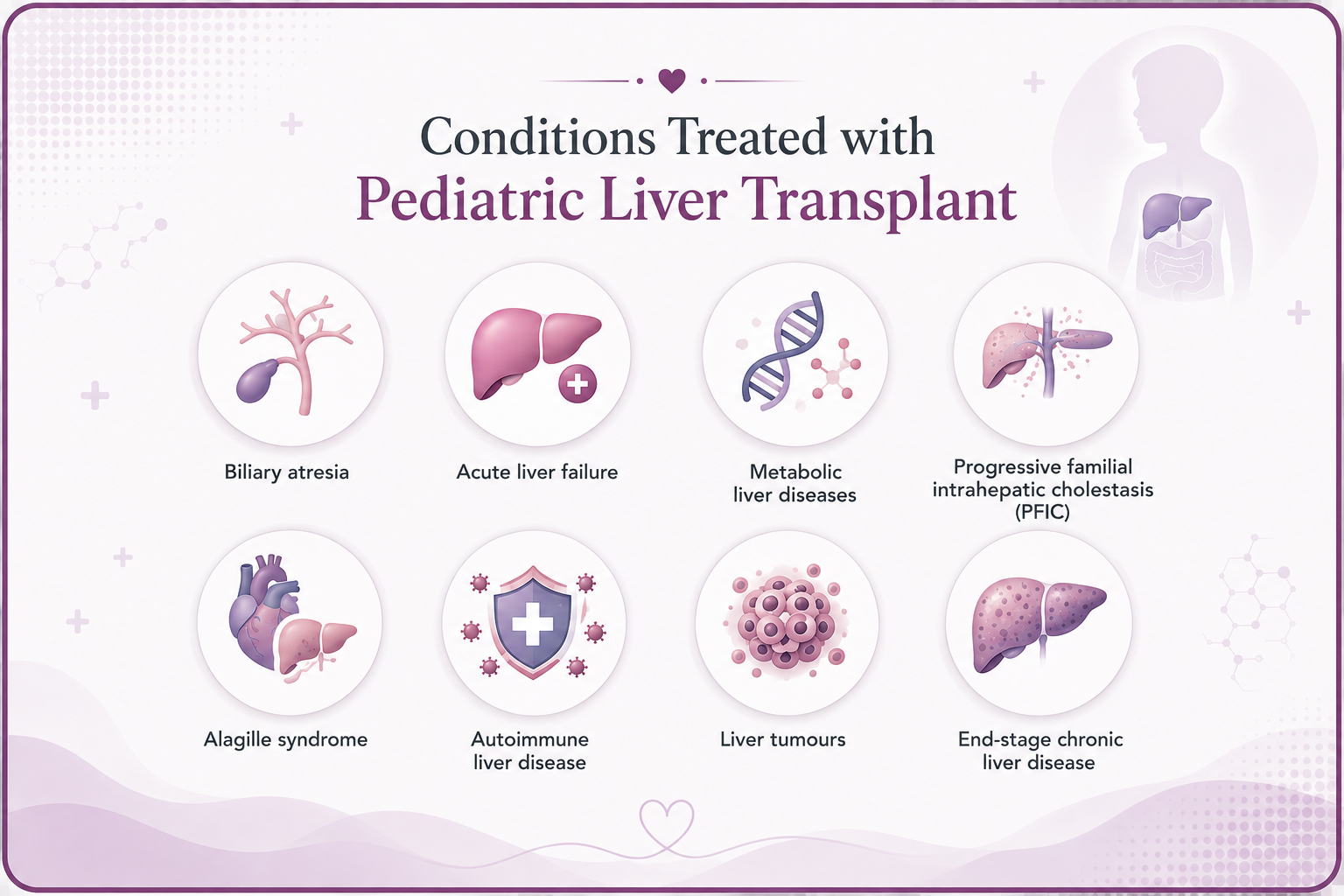 Conditions treated with pediatric liver transplant.png-Edited